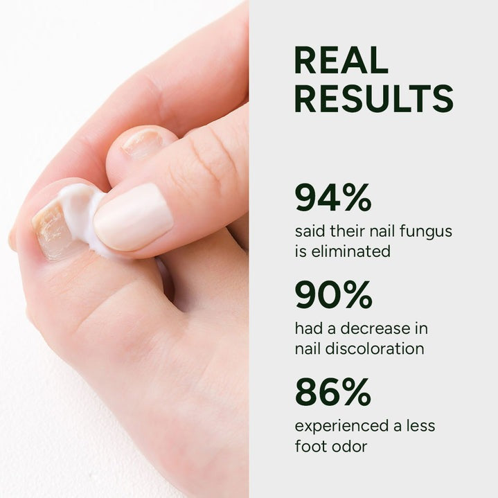 Behandlingsgel for neglesopp